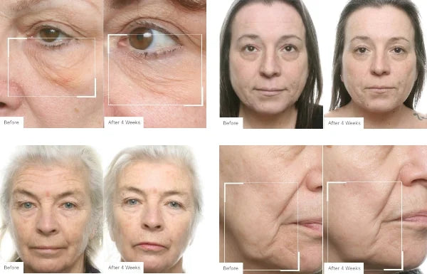 Neora Neo-FILLER | Lift + Fill Corrective Elixir